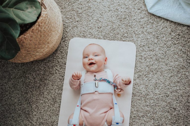 Hip Dysplasia